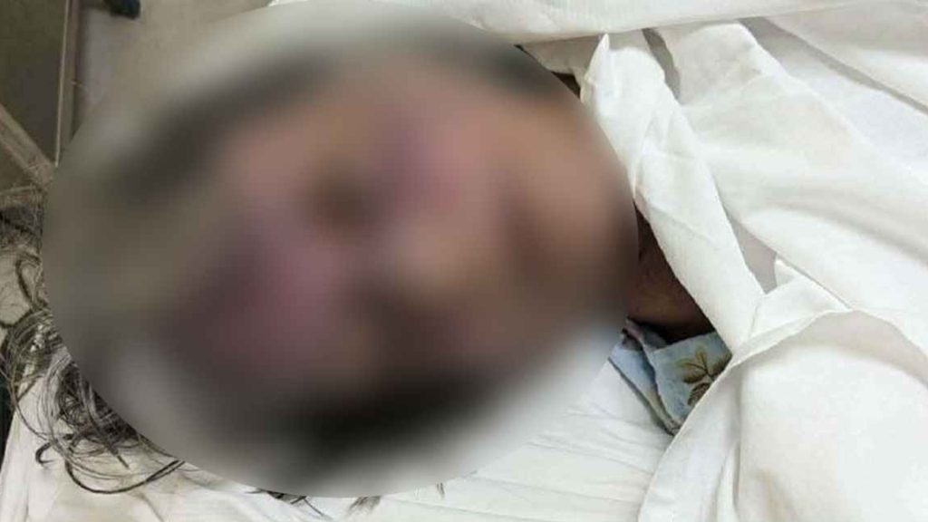 গুলশানে বিদেশি নাগরিককে পিটিয়ে হত্যার অভিযোগ
