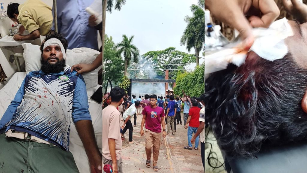 ভিসি নিয়োগ ঘিরে উত্তপ্ত ডুয়েট, সংঘর্ষে আহত একাধিক শিক্ষার্থী